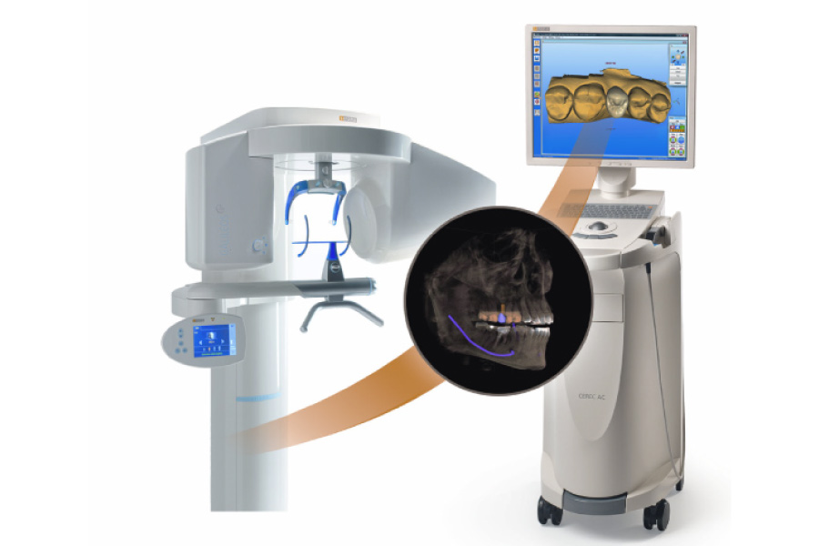 Drawing of CEREC same day crown milling machine & computer