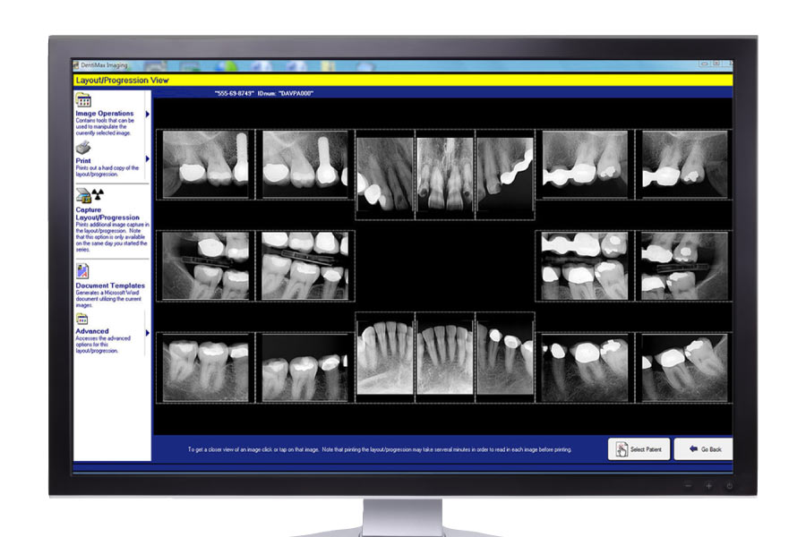 Computer screen showing digital X-rays.