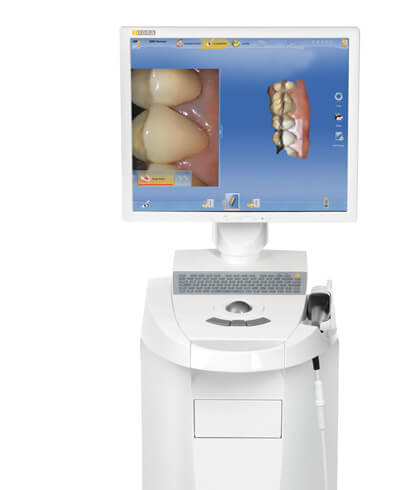 Cerec Crowns