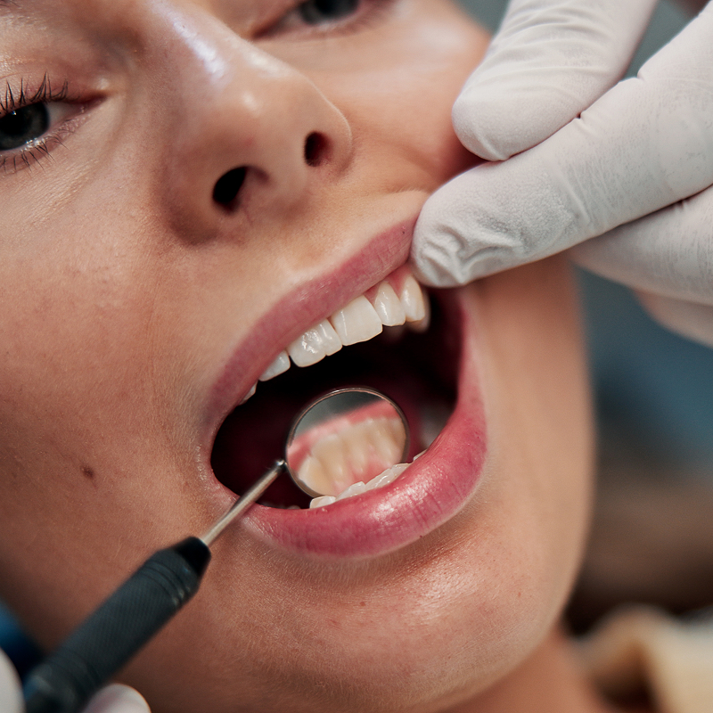 closeup of dental exam