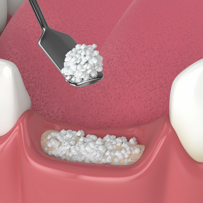 woman at the dentist